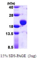 E. coli tpx Protein (Recombinant His)