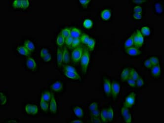 DDH / AKR1C1 Antibody