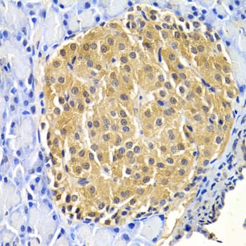 HTRA2 / OMI Antibody