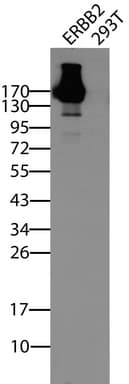 ERBB2 / HER2 Antibody (aa676-1255, clone UMAB34)