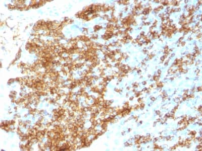 Recombinant Monoclonal Rabbit anti-Human CD45 / LCA Antibody (clone PTPRC/1783R, Azide-free,Carrier-free, IHC, IF, WB)