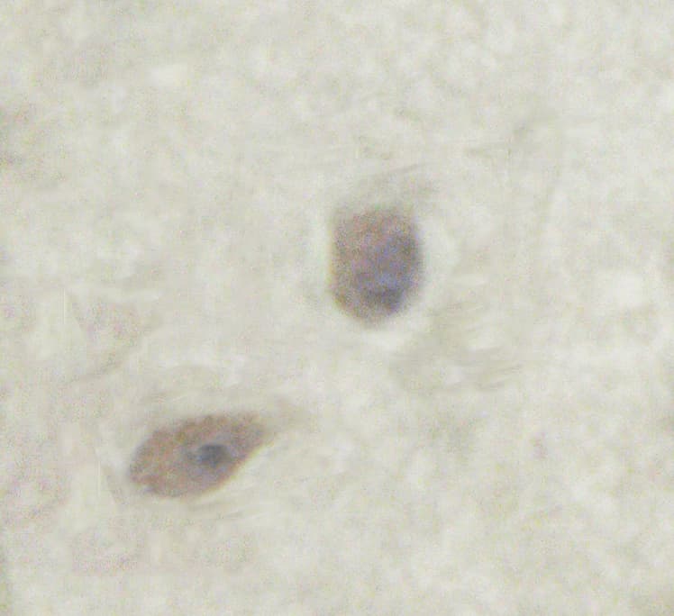 Polyclonal Rabbit anti-Human PRKCZ / PKC-Zeta Antibody (phospho-Thr560, IHC, IF, WB)