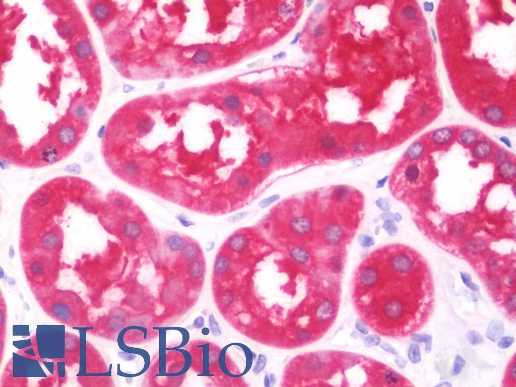 IHC-plus™ FBP1 Antibody (aa125-156)