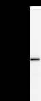 Monoclonal Mouse anti-Human HEC1 / NDC80 Antibody (clone 2497C3a, WB)