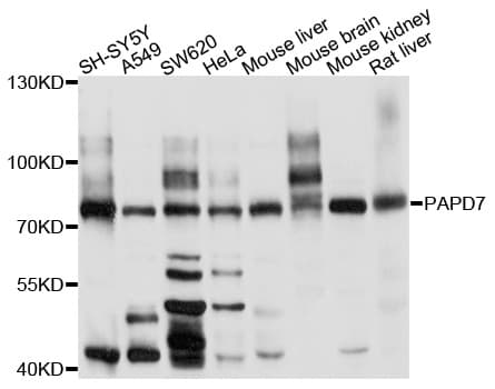 Polyclonal Rabbit anti-Human PAPD7 / TRF4-1 Antibody (WB)