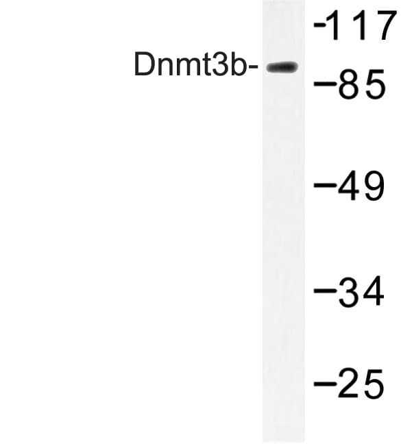DNMT3B Antibody (His7)