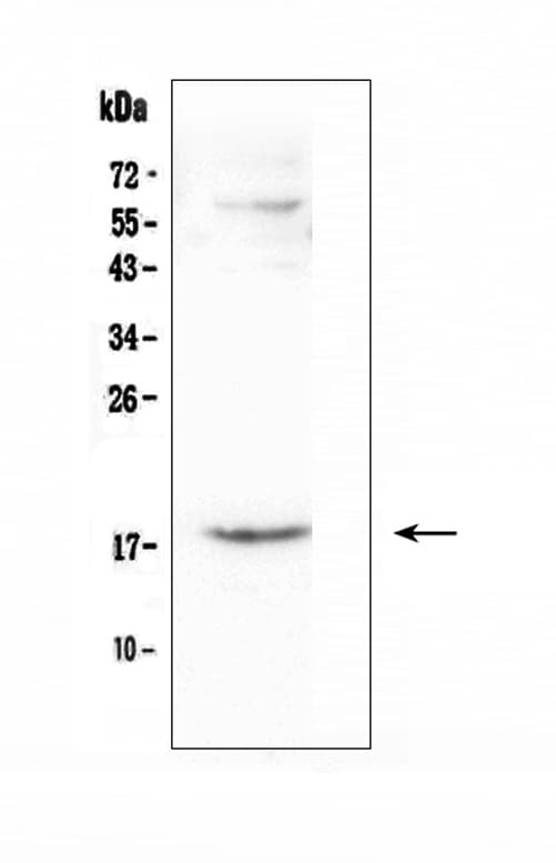Polyclonal Rabbit anti-Human CCL16 / LEC Antibody (WB)