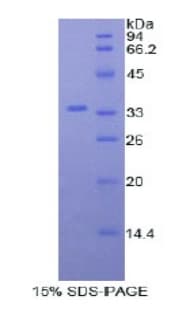 Mouse MYO1D Protein (Recombinant His)