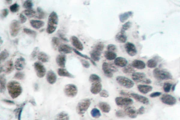 RB1 / Retinoblastoma / RB Antibody (phospho-Ser780)