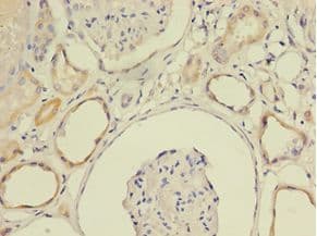 SCA2 / LY6E Antibody (aa21-101, HRP)