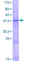 Human SLC35D2 Protein (Recombinant GST)
