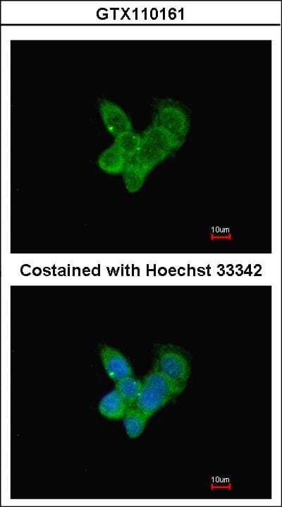 IHC-plus™ Complement C9 Antibody