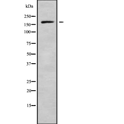 Polyclonal Rabbit anti-Human PREX1 / P-REX1 Antibody (IHC, WB)