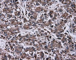 NPR3 Antibody (clone OTI2C2, Carrier-free)