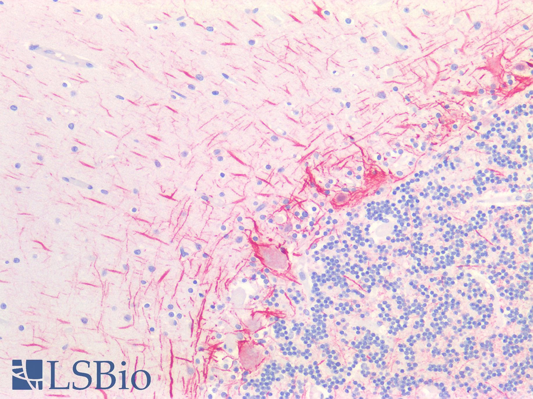 PathPlus™ Polyclonal Rabbit anti-Human NF-L / NEFL Antibody (IHC, IF, WB)