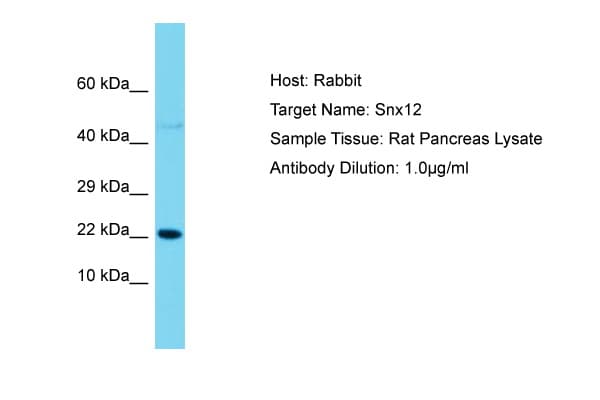 SNX12 Antibody (aa86-135)