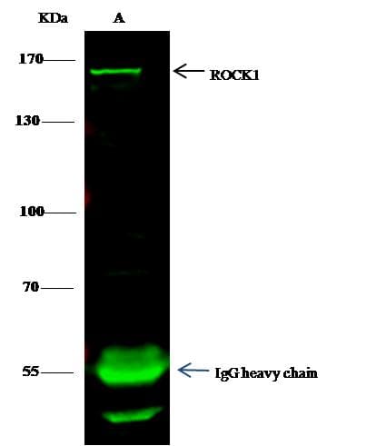 Rho Kinase / ROCK1 Antibody (Preservative Free)