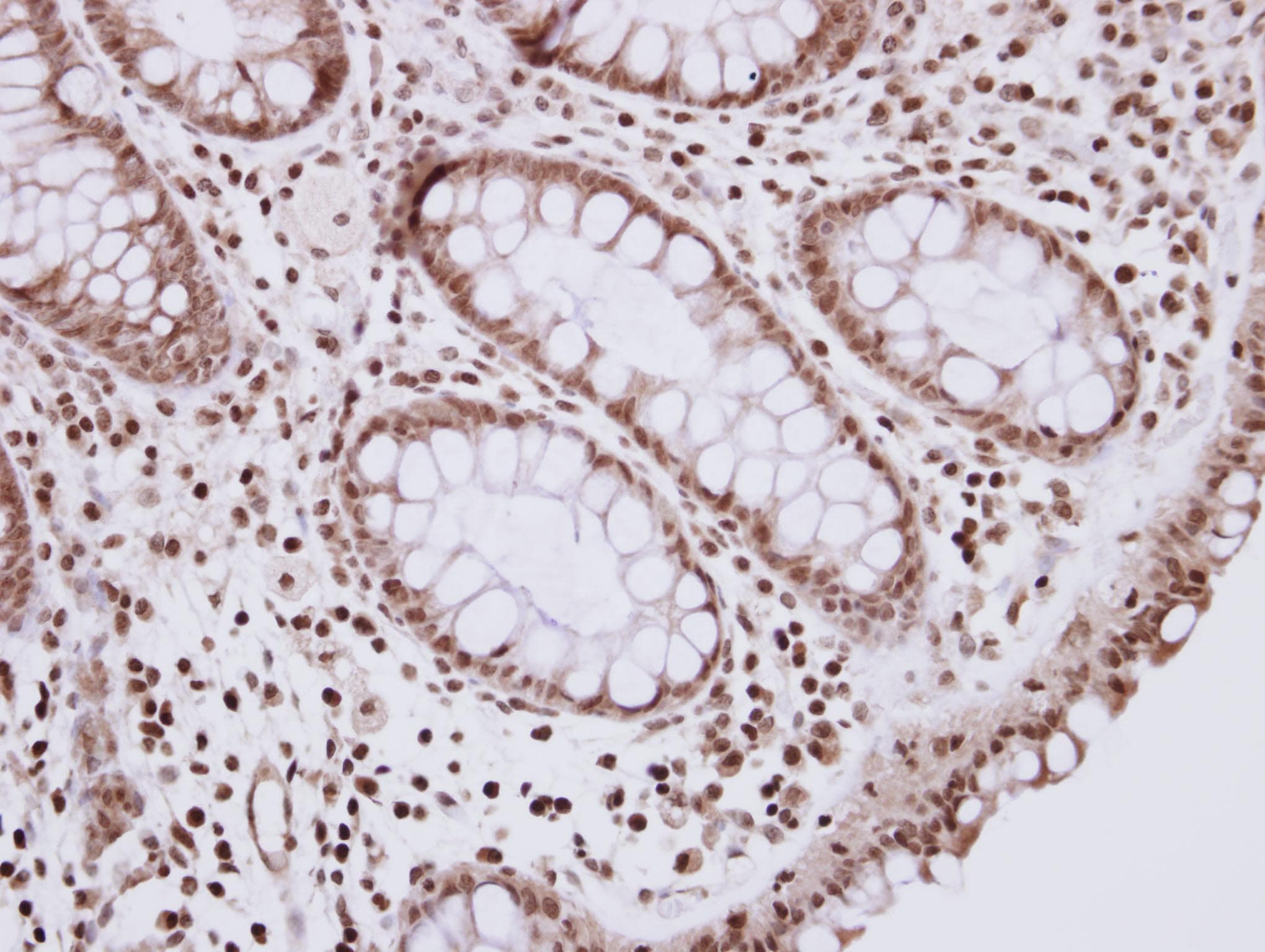 R3HDM2 Antibody (Internal)