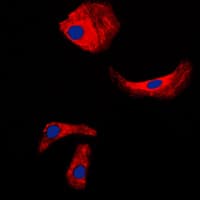 KLK3 / PSA Antibody (Internal)