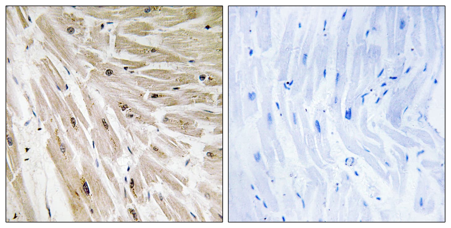 RPL22 / Ribosomal Protein L22 Antibody (aa51-100)