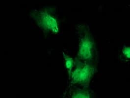 VMD2L3 / BEST3 Antibody (clone OTI2H3)