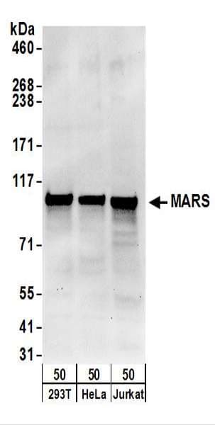 Polyclonal Rabbit anti-Human MARS Antibody (aa175-225, IHC, WB)