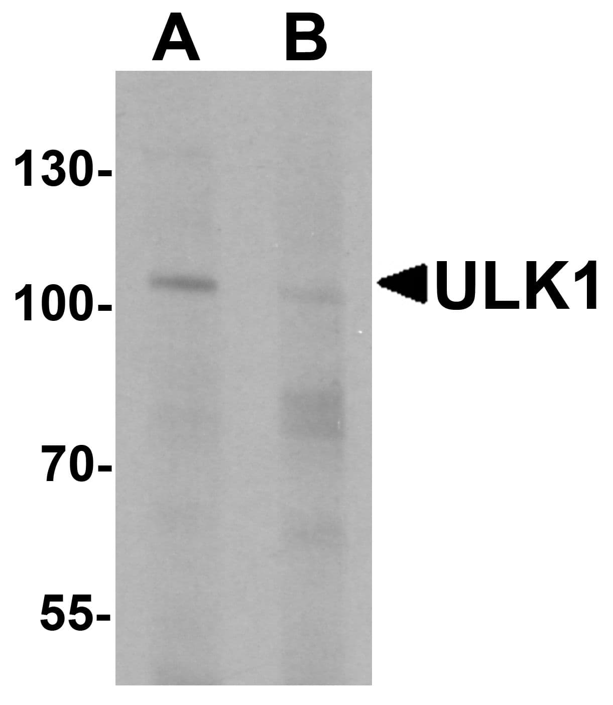IHC-plus™ Polyclonal Rabbit anti-Human ULK1 Antibody (IHC, IF, WB)