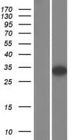 AUTS2 Protein (Over-Expression Lysate Myc-DDK (Flag))