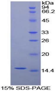 Human CEA / Carcinoembryonic Antigen Protein (Recombinant His, N-Terminal)