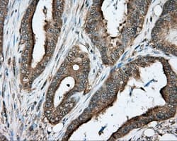 PRKAR2A Antibody (clone OTI4H8, Carrier-free)