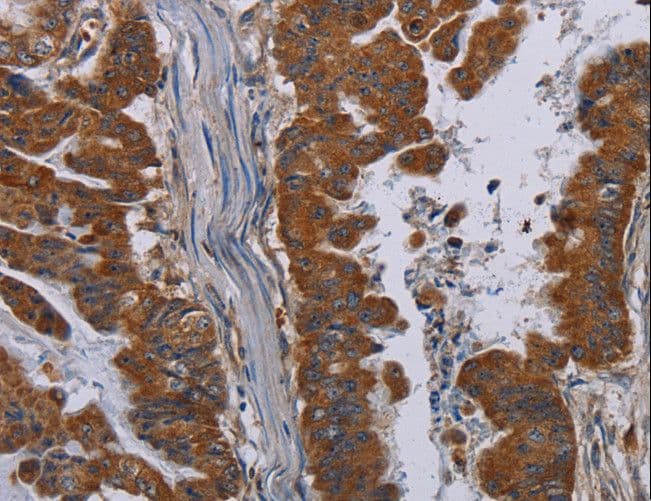 PVRL3 / Nectin-3 Antibody