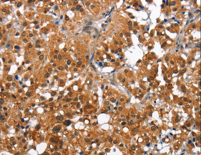 CAMK1D Antibody