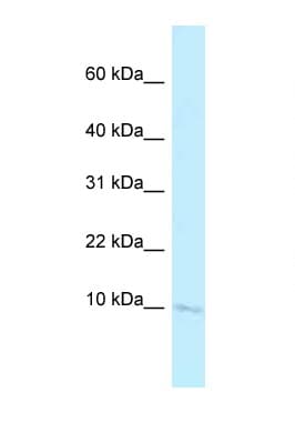 BANF2 Antibody (N-Terminus)