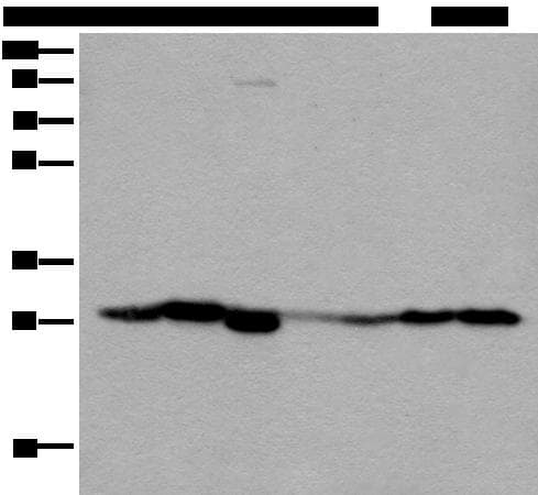 Polyclonal Rabbit anti-Human VTI1B Antibody (IHC, WB)