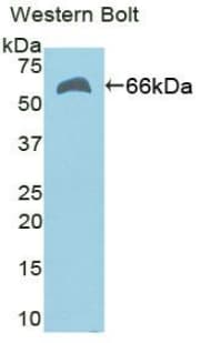 TERT / Telomerase Antibody (aa787-1084)