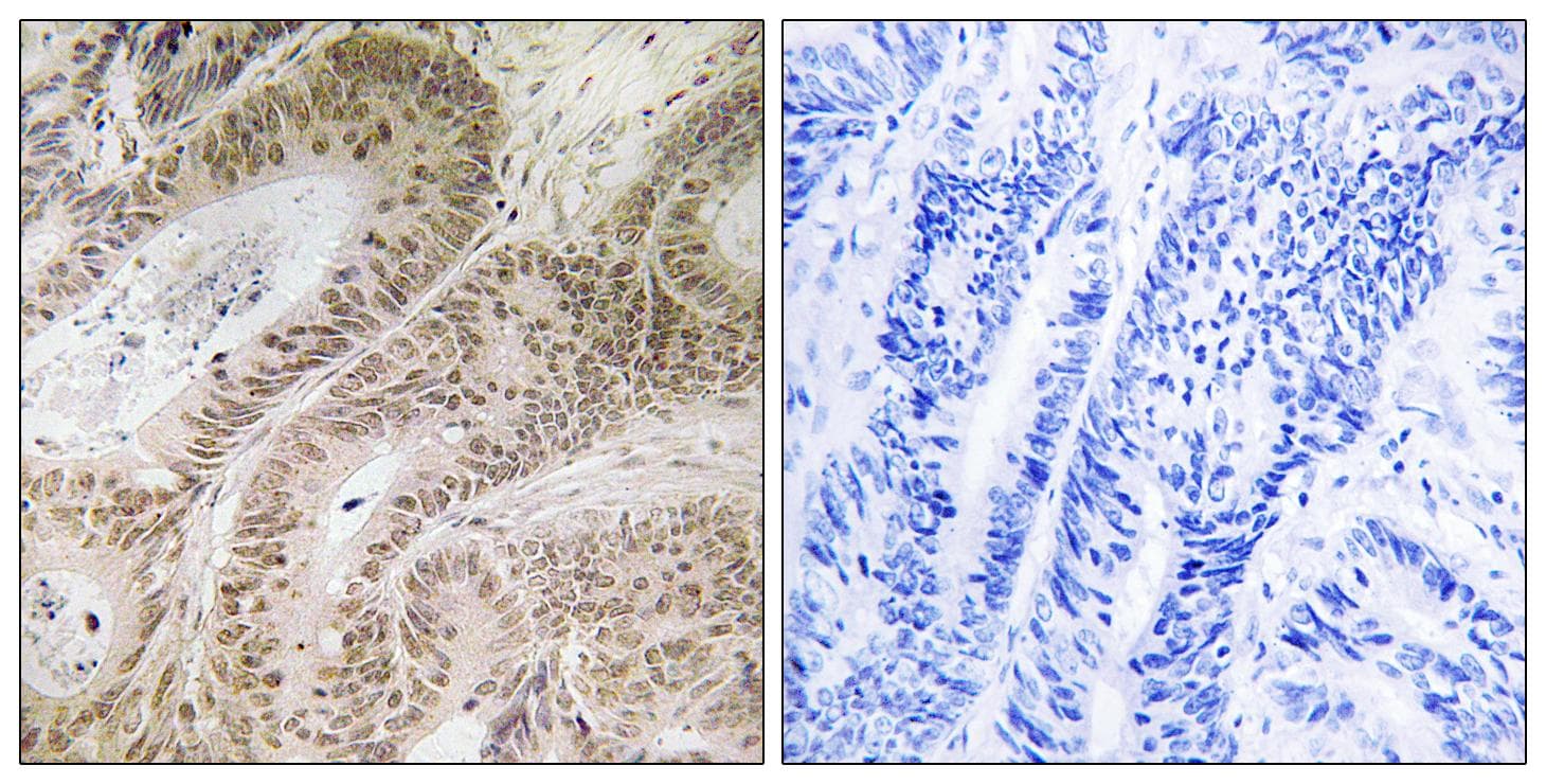 RDM1 Antibody