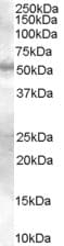 IHC-plus™ SMAD9 Antibody (aa166-179)