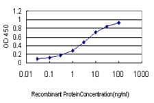 PR / Progesterone Receptor Antibody (clone 5D10)