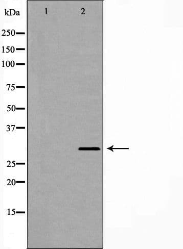 PSMB4 Antibody
