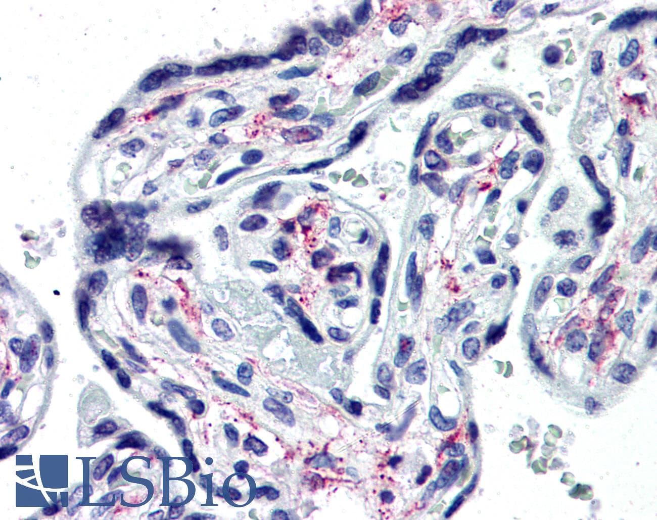 IHC-plus™ IL1R1 Antibody (Extracellular Domain, clone IL1-31-22.2.1)