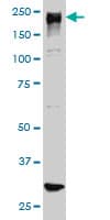 IHC-plus™ ARID1B / BAF250B Antibody (clone 2D2)