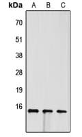FABP4 / AP2 Antibody (C-Terminus)
