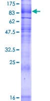 Human SLC5A2 / SGLT2 Protein (Recombinant GST)