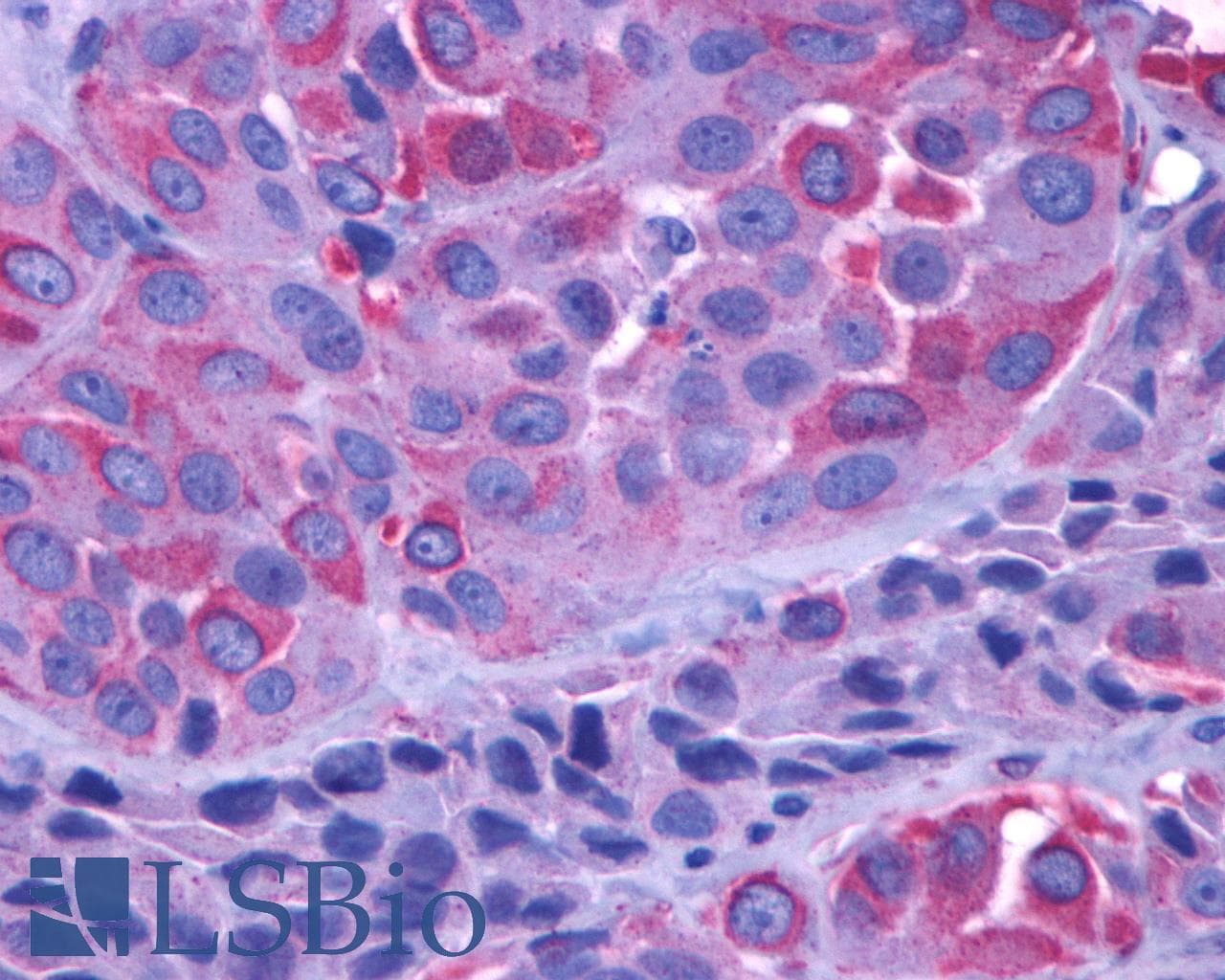 PathPlus™ Polyclonal Rabbit anti-Human GRM1 / MGLUR1 Antibody (C-Terminus, IHC)