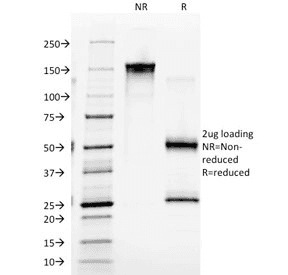 EGFR Antibody (clone GFR/2341)