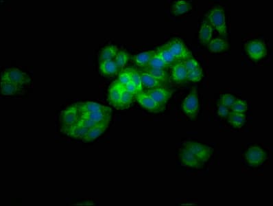 ARSE / Arylsulfatase E Antibody