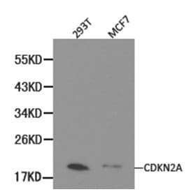 IHC-plus™ p16INK4a / CDKN2A Antibody