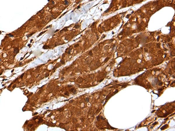 LIPG / Endothelial Lipase Antibody