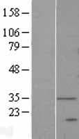 DEGS1 Protein (Over-Expression Lysate Myc-DDK (Flag))