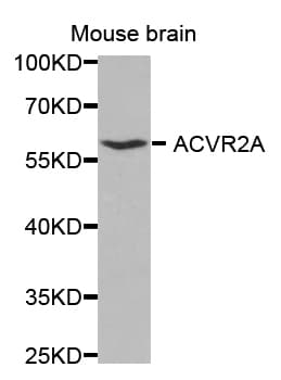 Polyclonal Rabbit anti-Human ACVR2 / ACVR2A Antibody (IHC, WB)